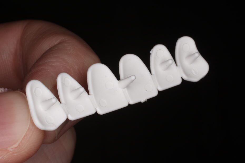 Anterior Template