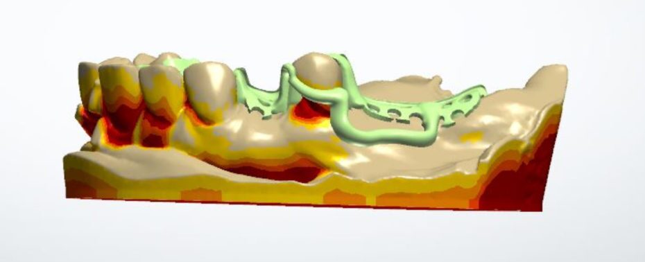 CAD design of frame
