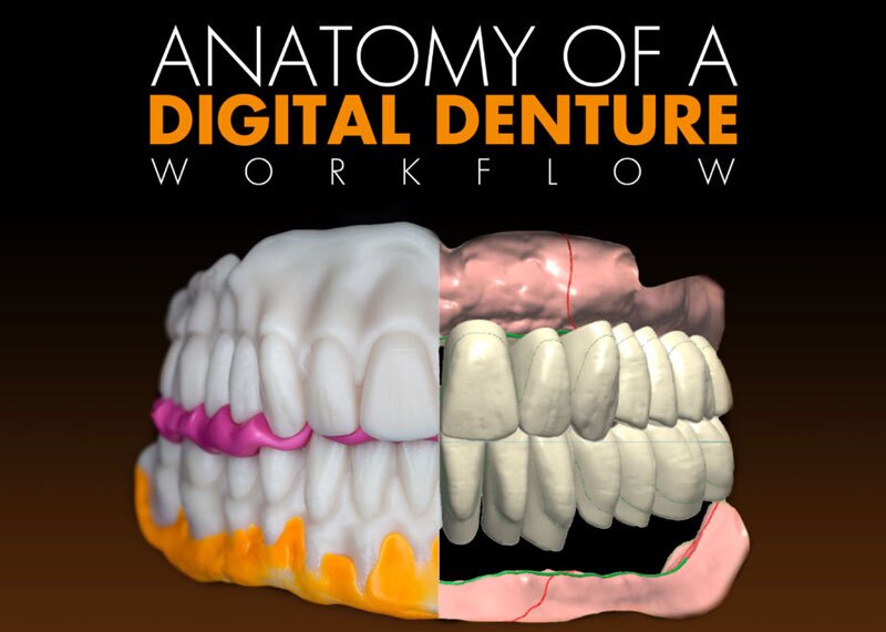 anatomy of digital denture workflow