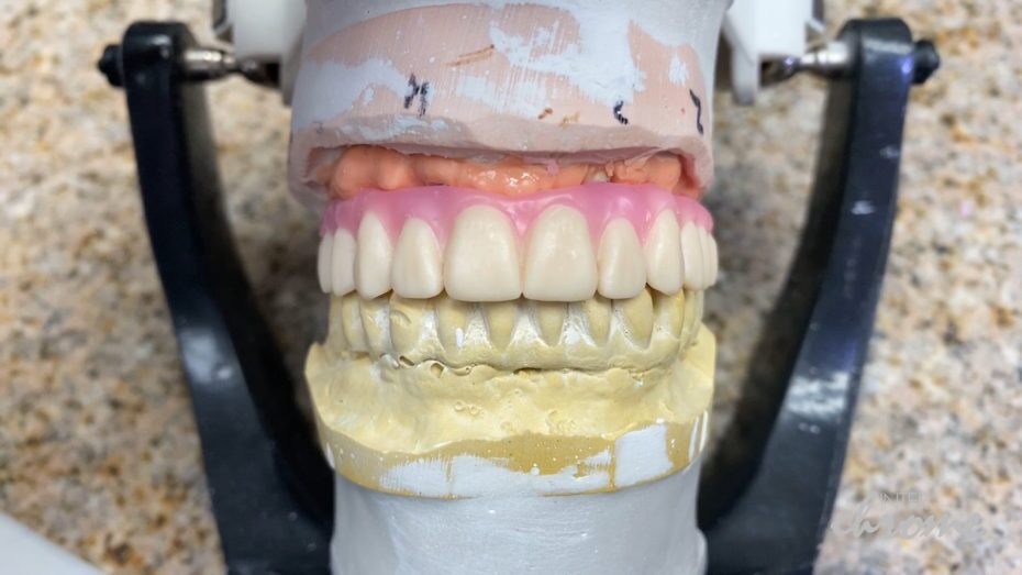 Waxed up printed prototype on top of bar