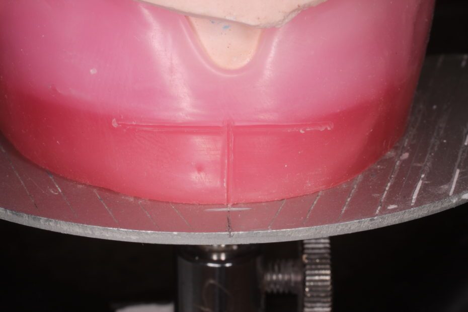 Midline Marking on Plate