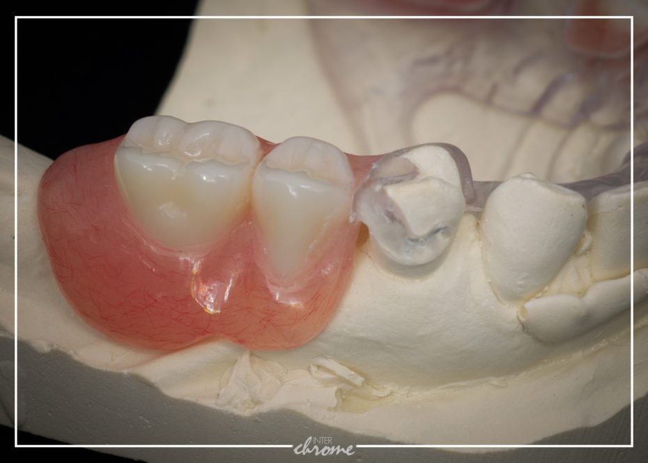 Clasp assembly and acrylic