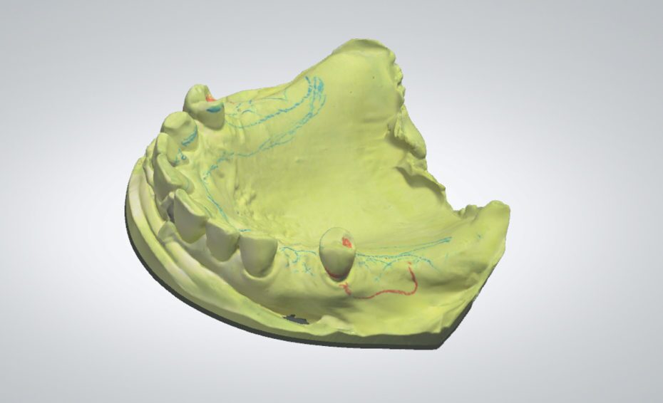 scan of analog master model