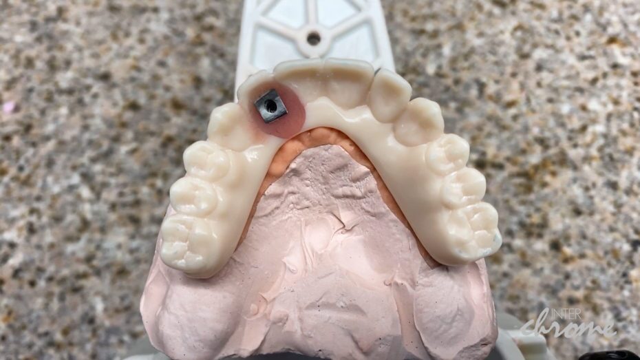 Screw retained printed prototype