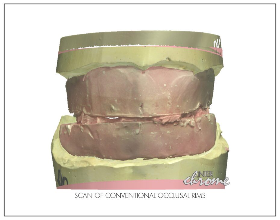 scan of occlusal rims
