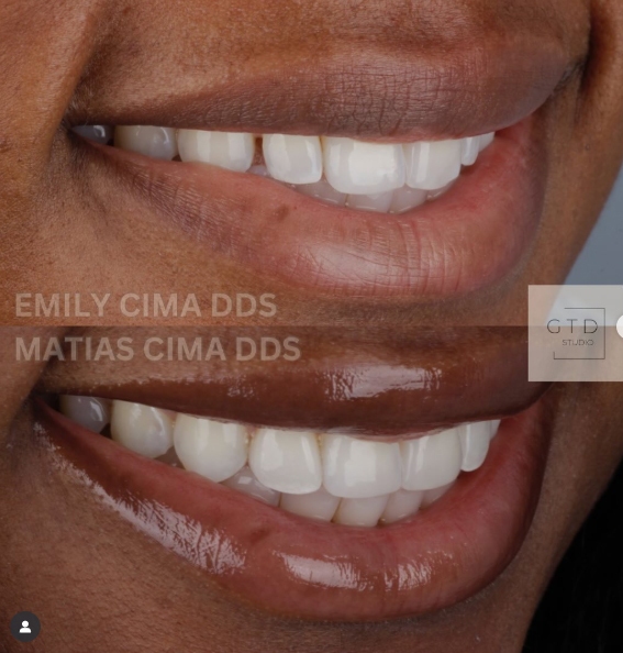 smile transformed inter-chrome dental